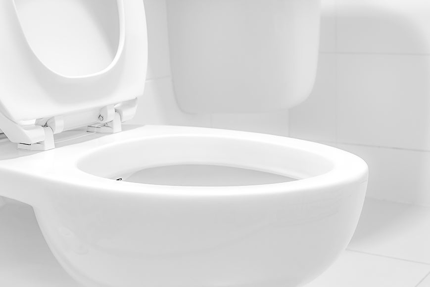 Vaso sanitário encardido sendo limpo com escova e produto de limpeza para remoção de manchas